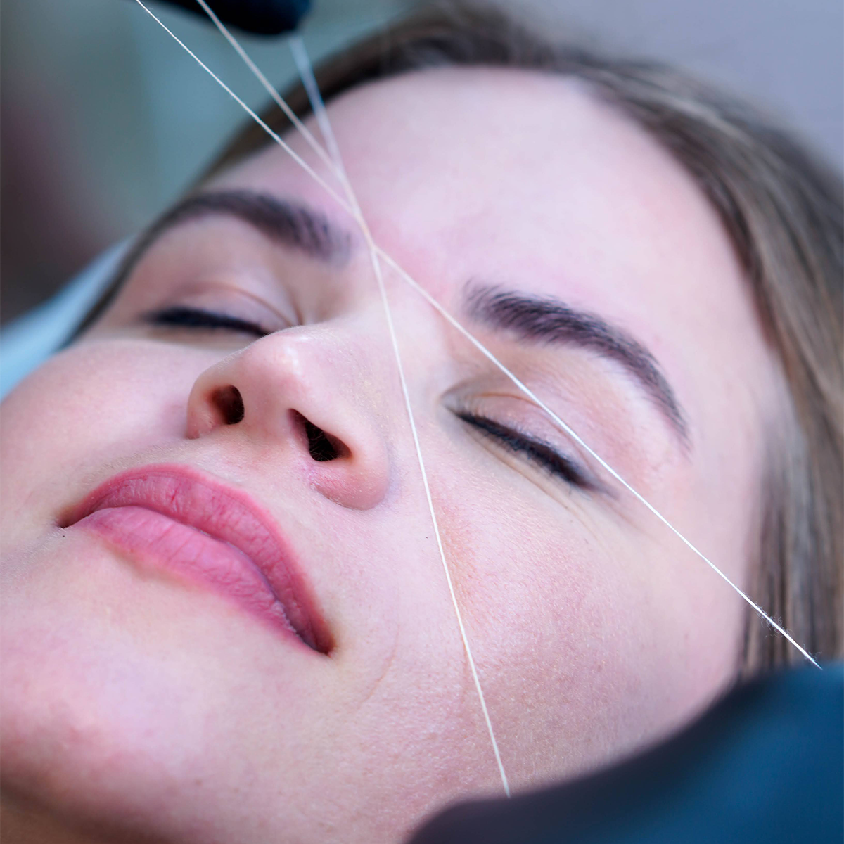 Facial — imagem 1